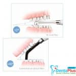 Original-Woodpecker-One-Cure-B-Cure-Plus-Dental-Curing-Light.-600×600