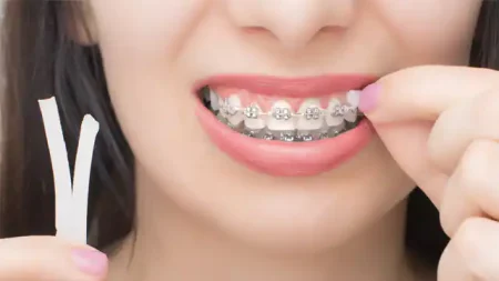 CareDent OrthoWax