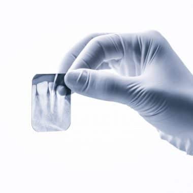 Dental X-Rays Dental Photography Product- Dentaplus Dental Supplies Australia